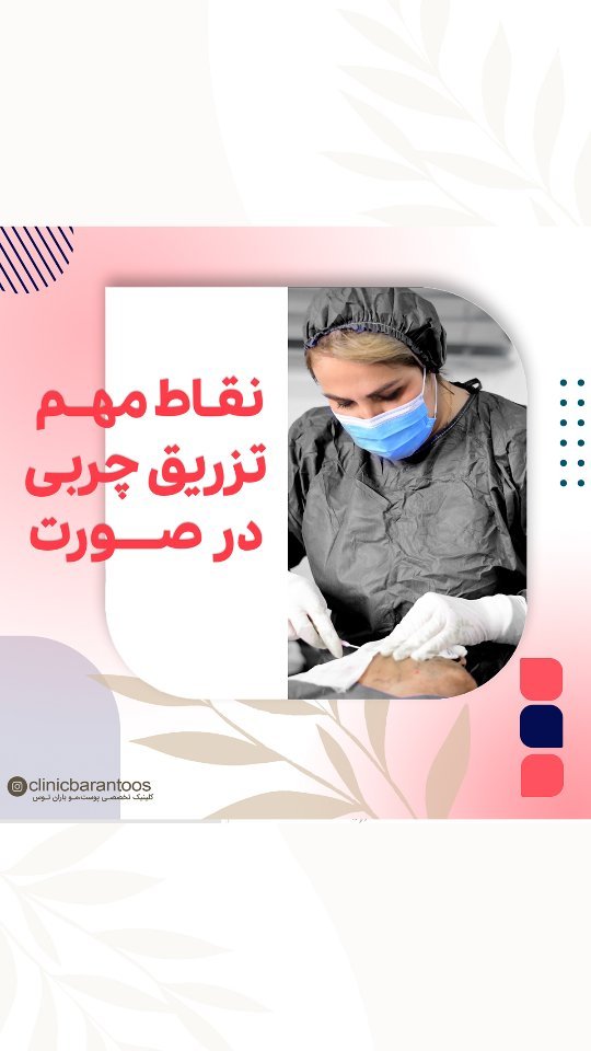 نقاط مهم تزریق چربی در صورت + نکات، مراحل و فیلم